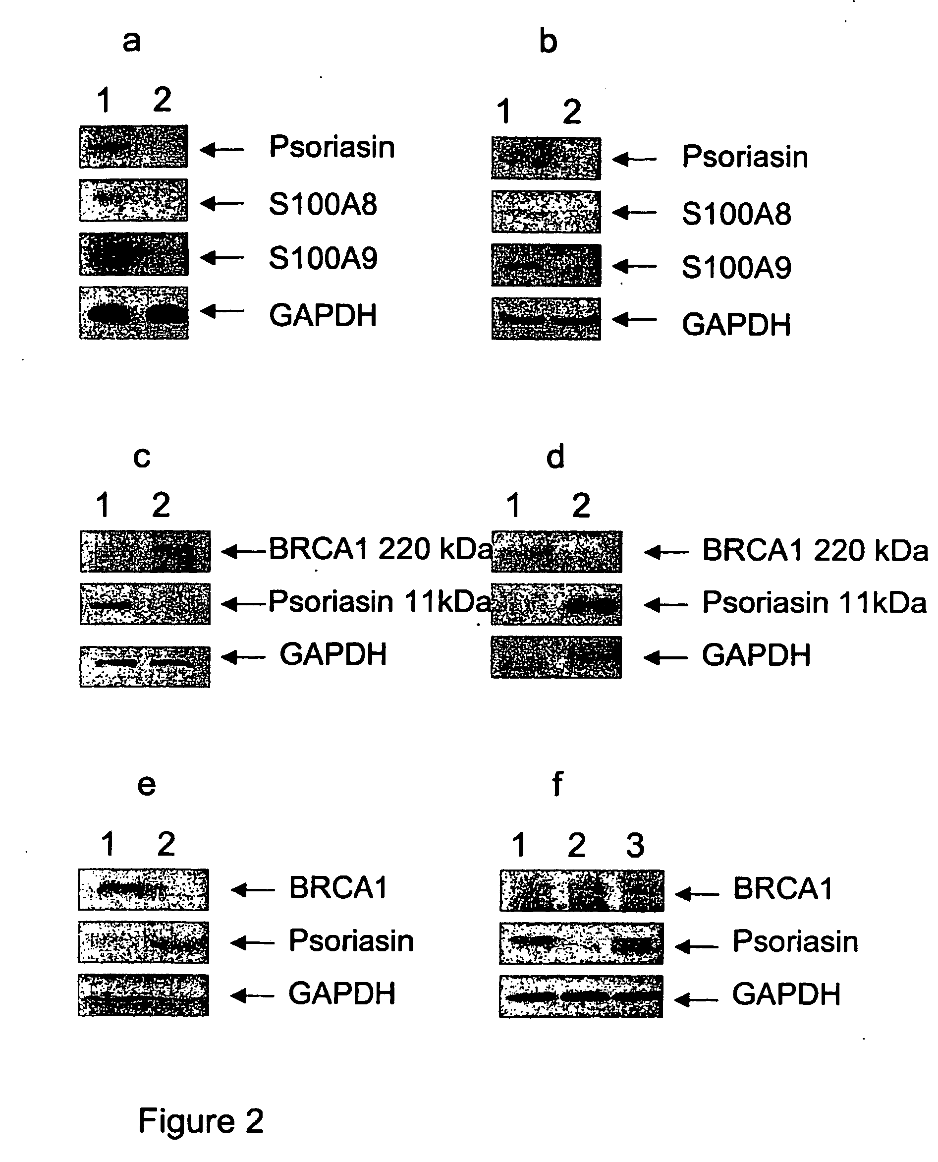 Brca1 Markers