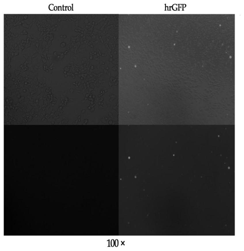 Preparation method and application of efficient recombinant adenovirus vector based on AdEasy&lt;TM&gt; system