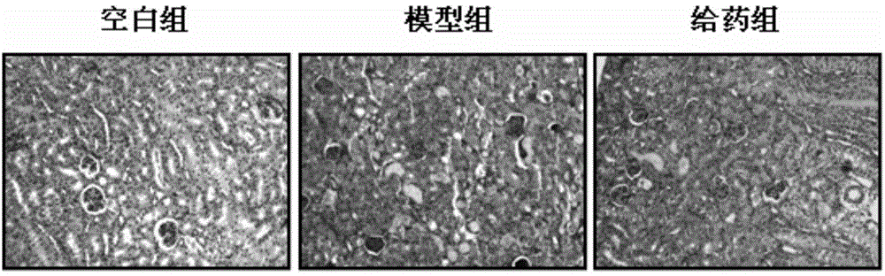 Traditional chinese medicine composite with function of treating renal injury caused by cis-platinum