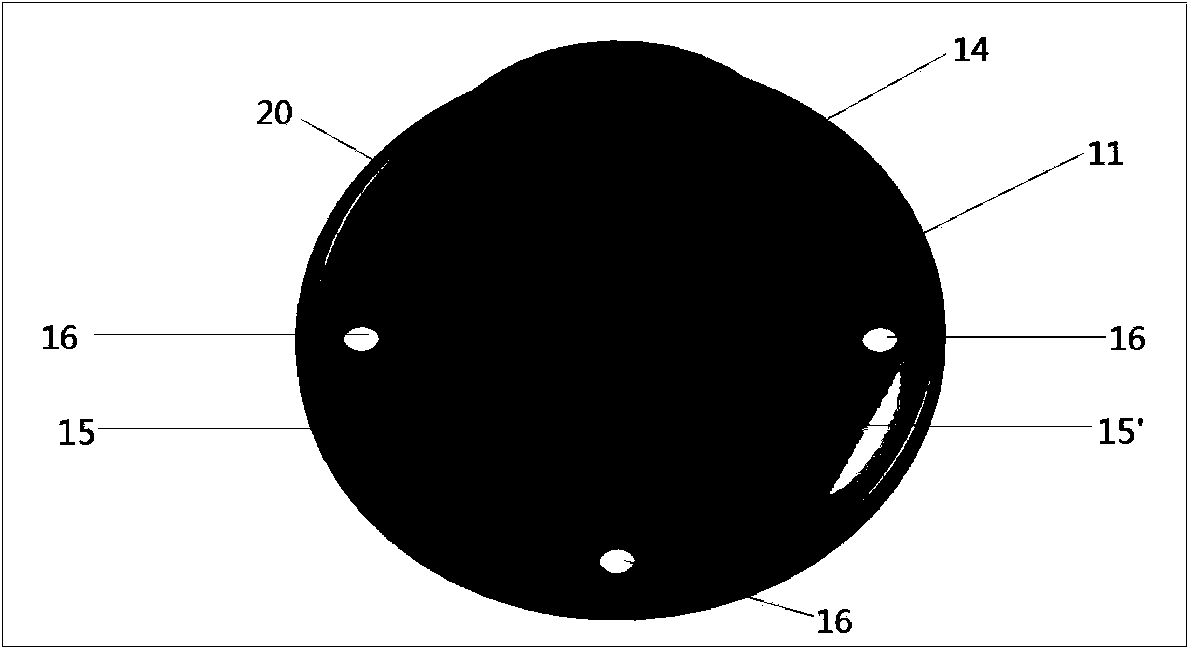 Medical shunt device for portal hypertension