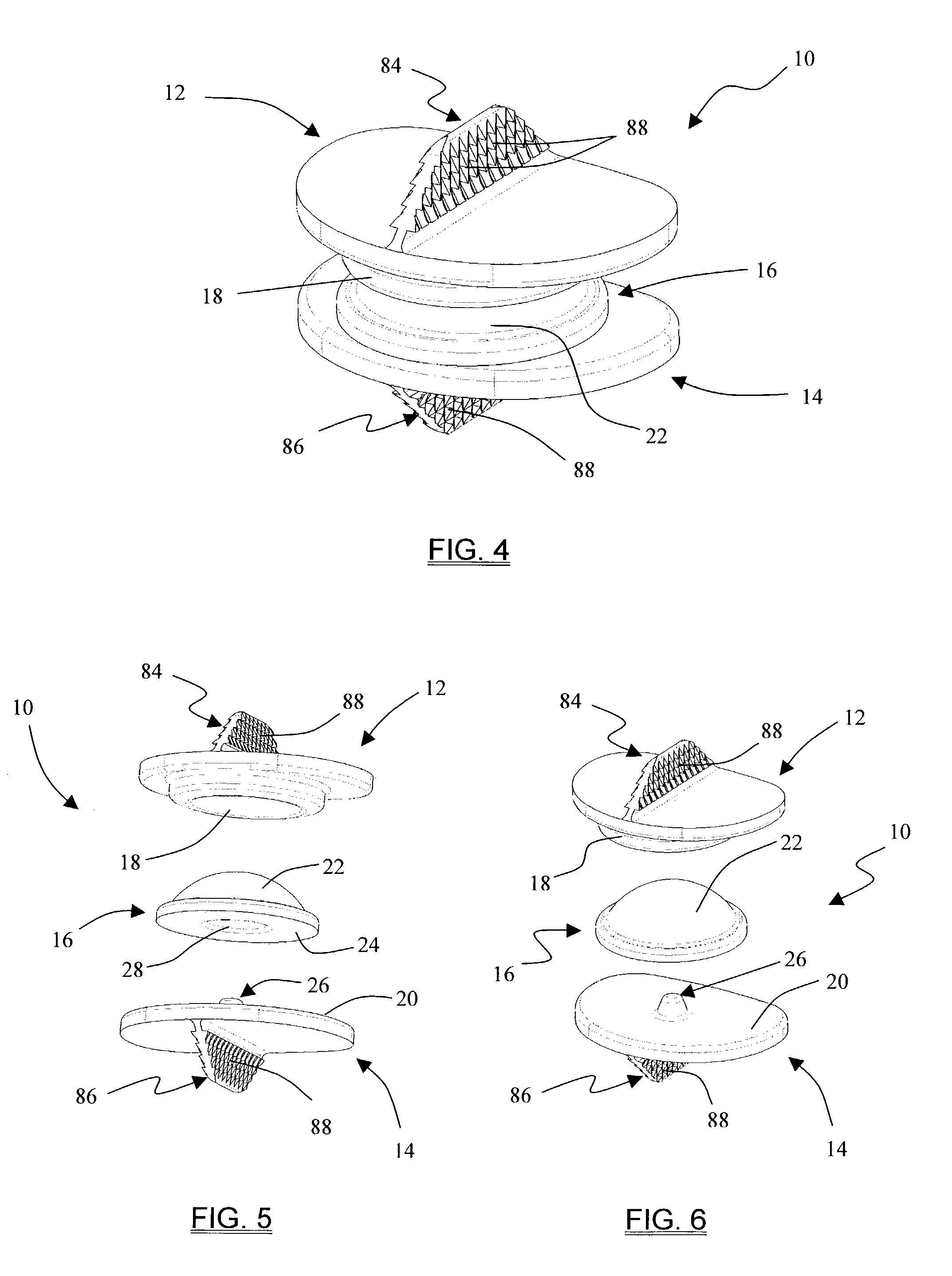 Intervertebral disk replacement system and methods
