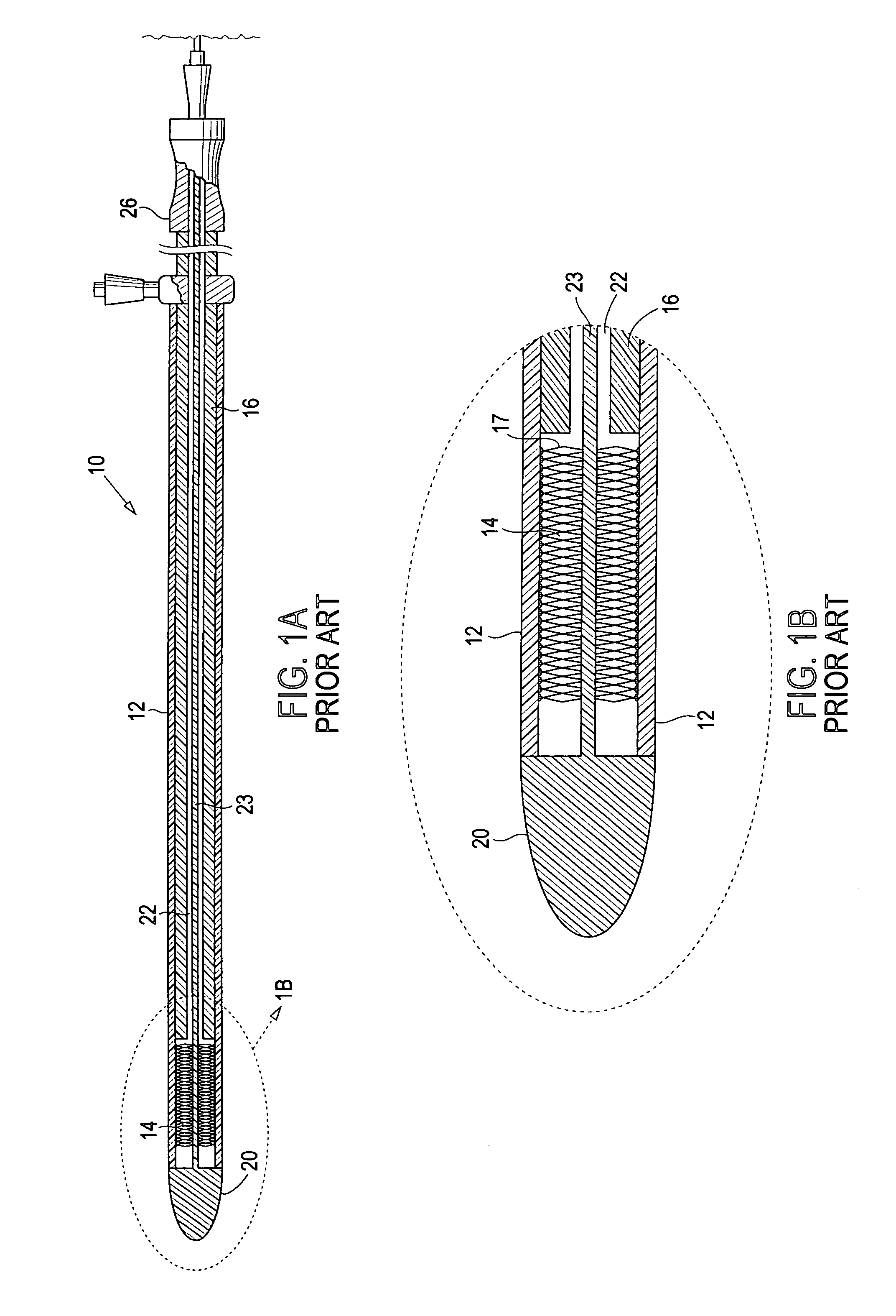 Method and apparatus for deployment of an endoluminal device