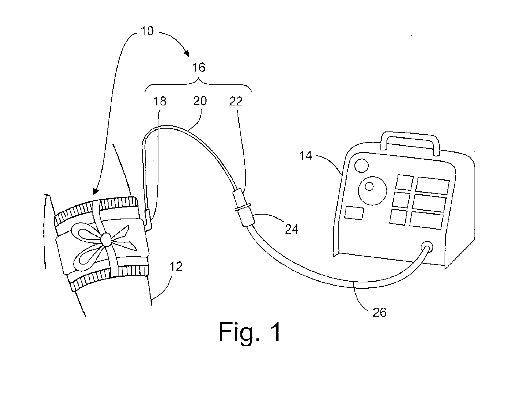 Manufacture and Use of Tourniquet Cuff with Improved Pneumatic Passageway