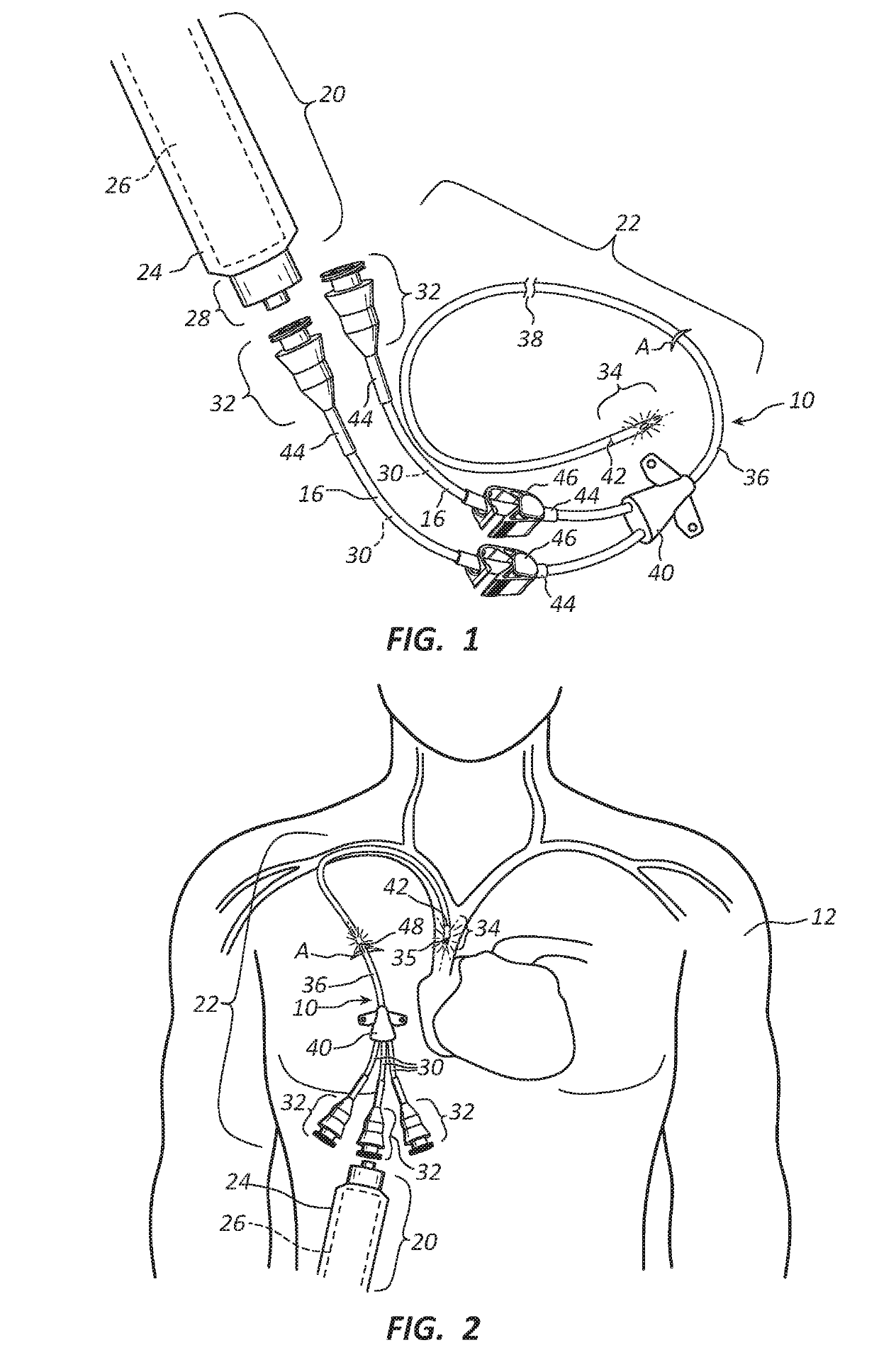 Methods and apparatus to deliver therapeutic, non-ultraviolet electromagnetic radiation versatilely via  a catheter residing in a body cavity