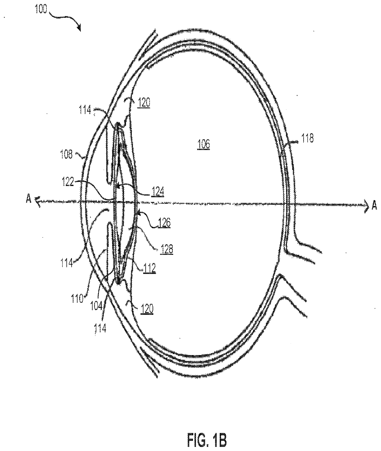 Lens oil having a narrow molecular weight distribution for intraocular lens devices