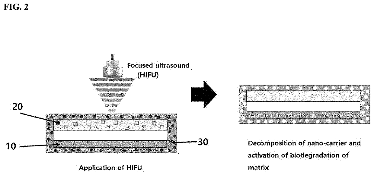 Triboelectric generator including nano-composite time--limited via selective ultrasound application thereto and neurostimulation therapy device using the same