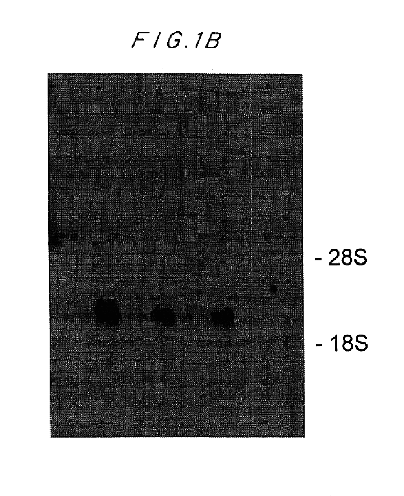 Intracellular glucocorticoid-induced leucine zippers modulators of apoptic cell death pathways