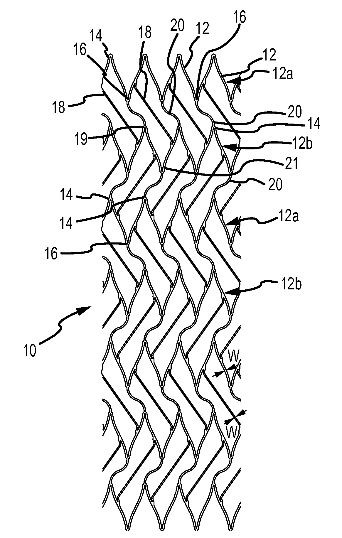 Radially Expandable Stent