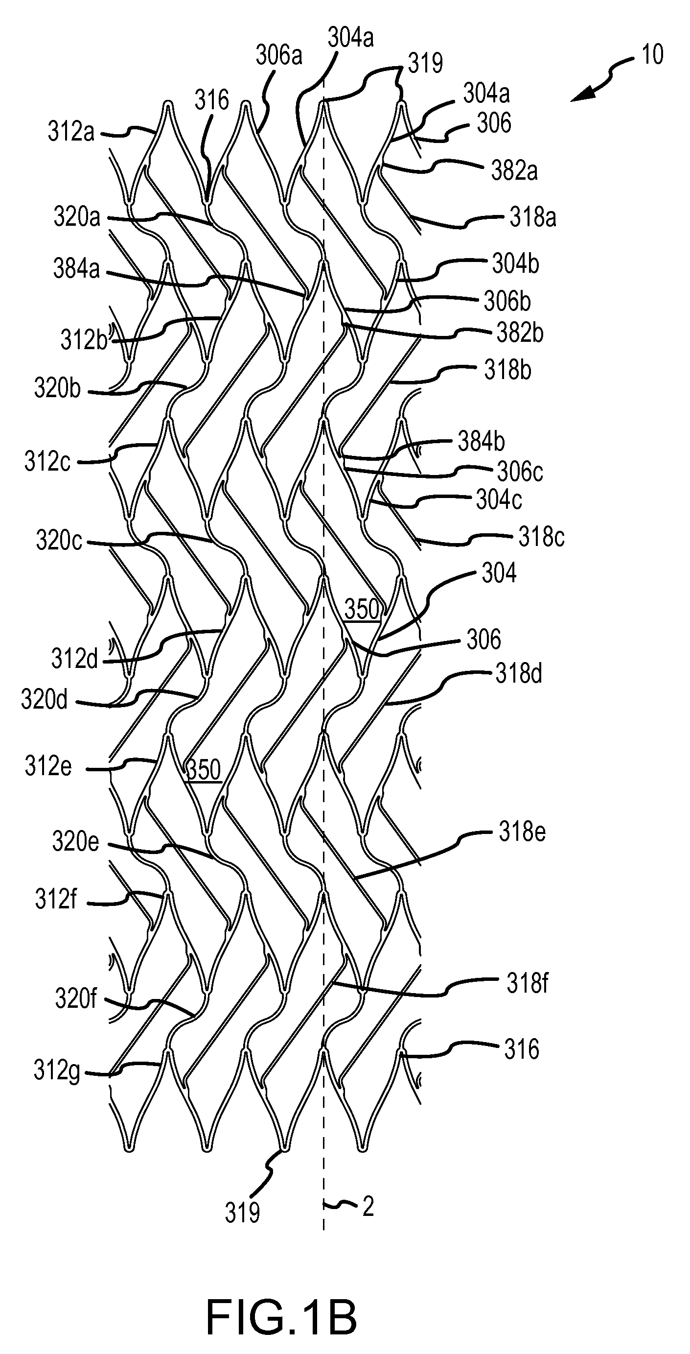 Radially Expandable Stent