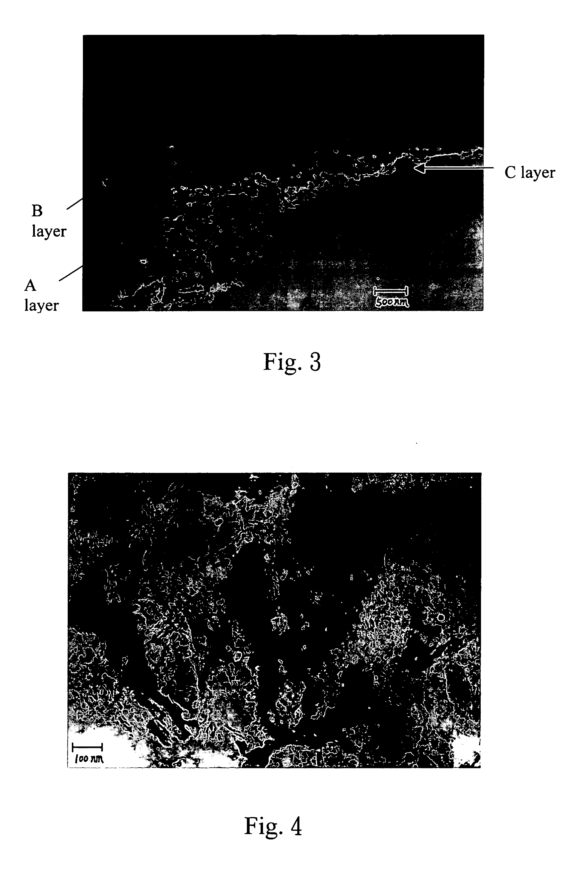 Method for treating surface of magnesium or magnesium alloy