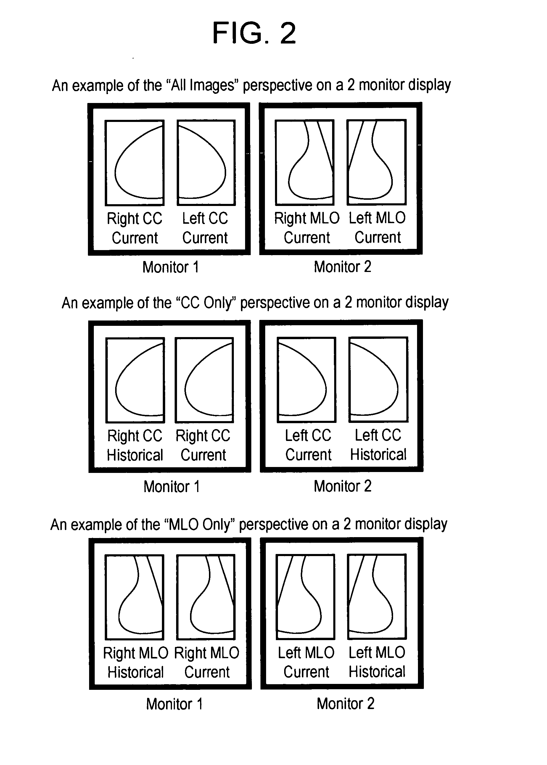 System and method for displaying image studies using hanging protocols with perspectives/views