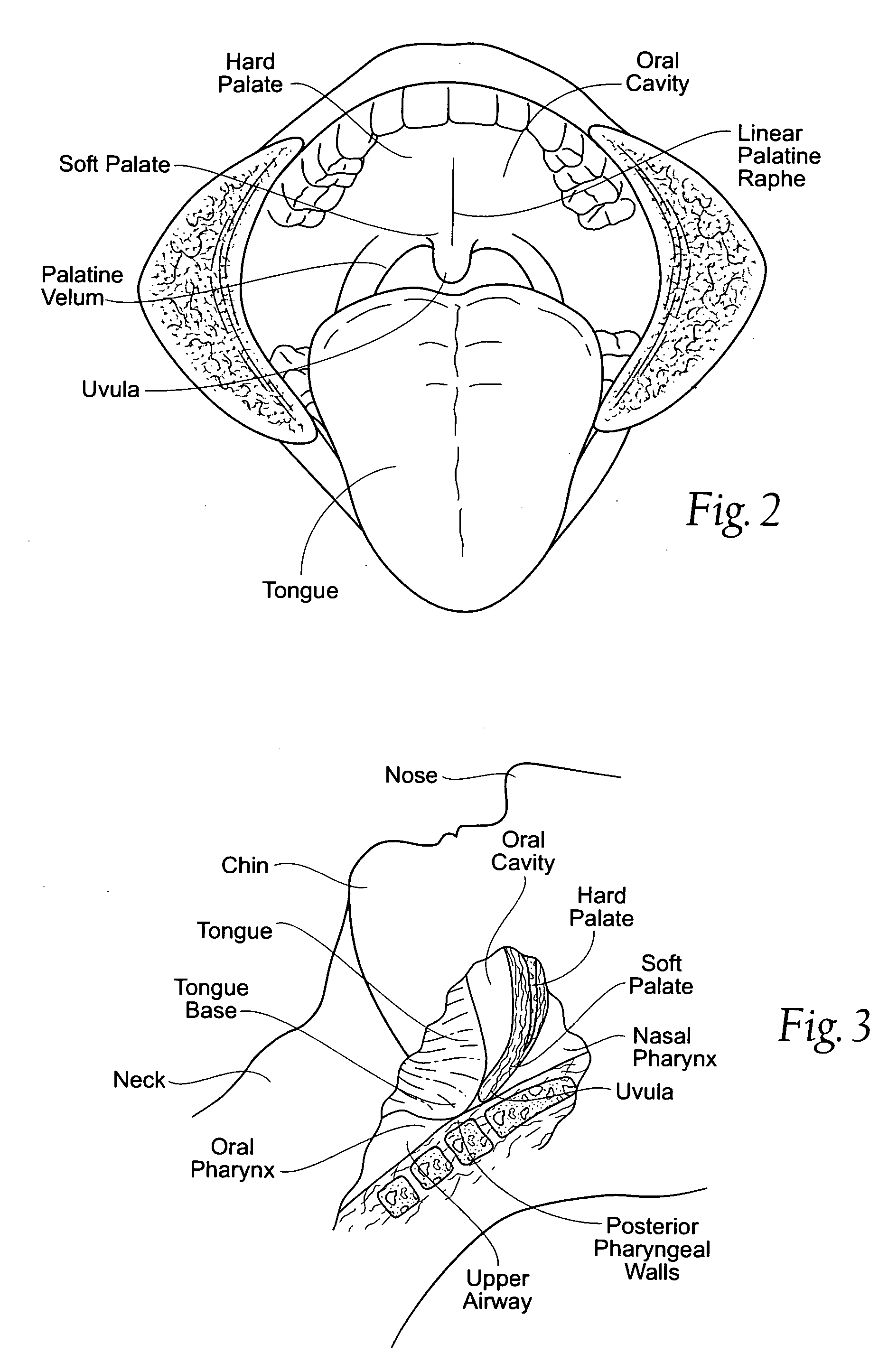 Stabilized magnetic force devices, systems and methods