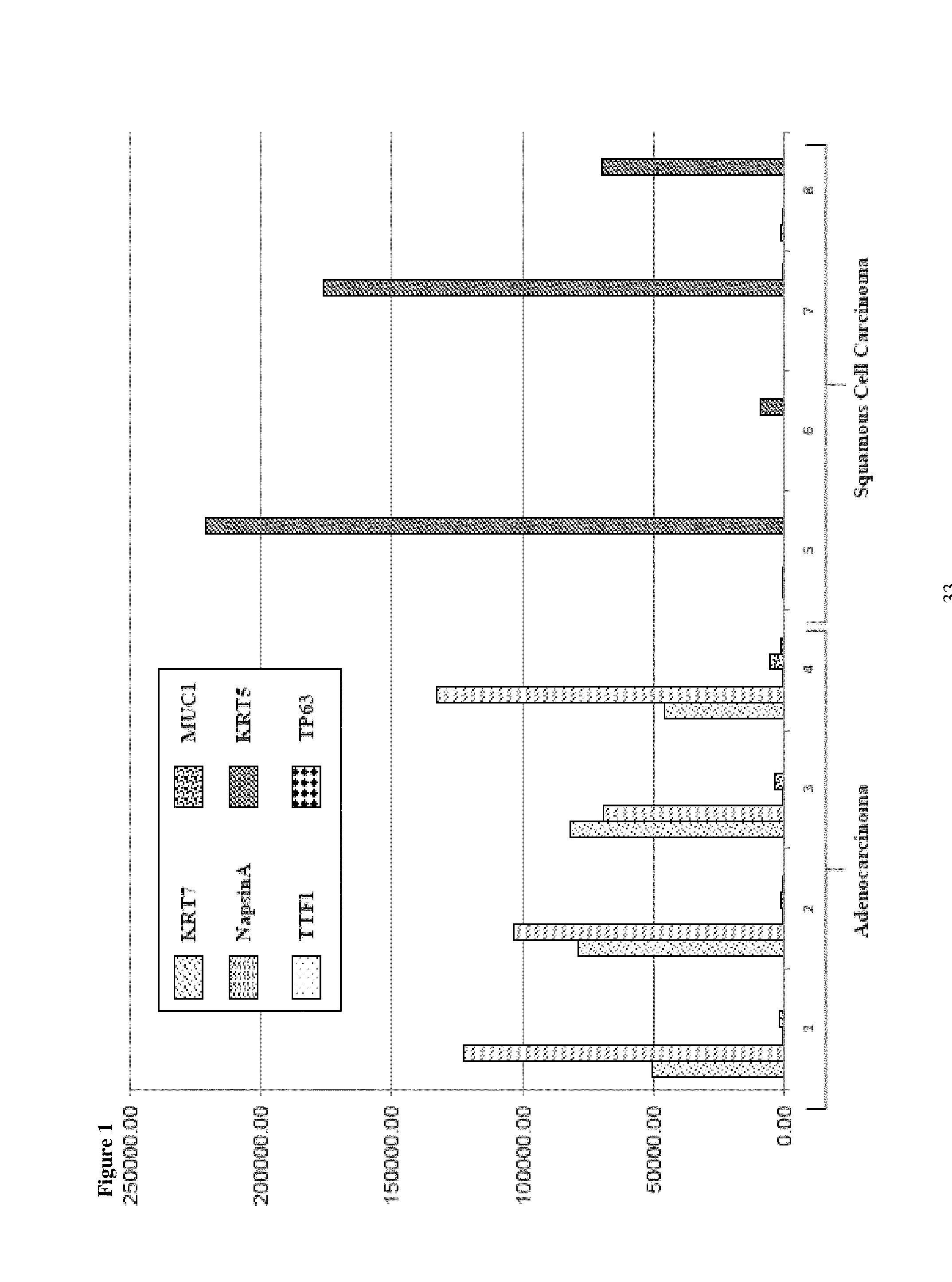 SRM/MRM assay for subtyping lung histology