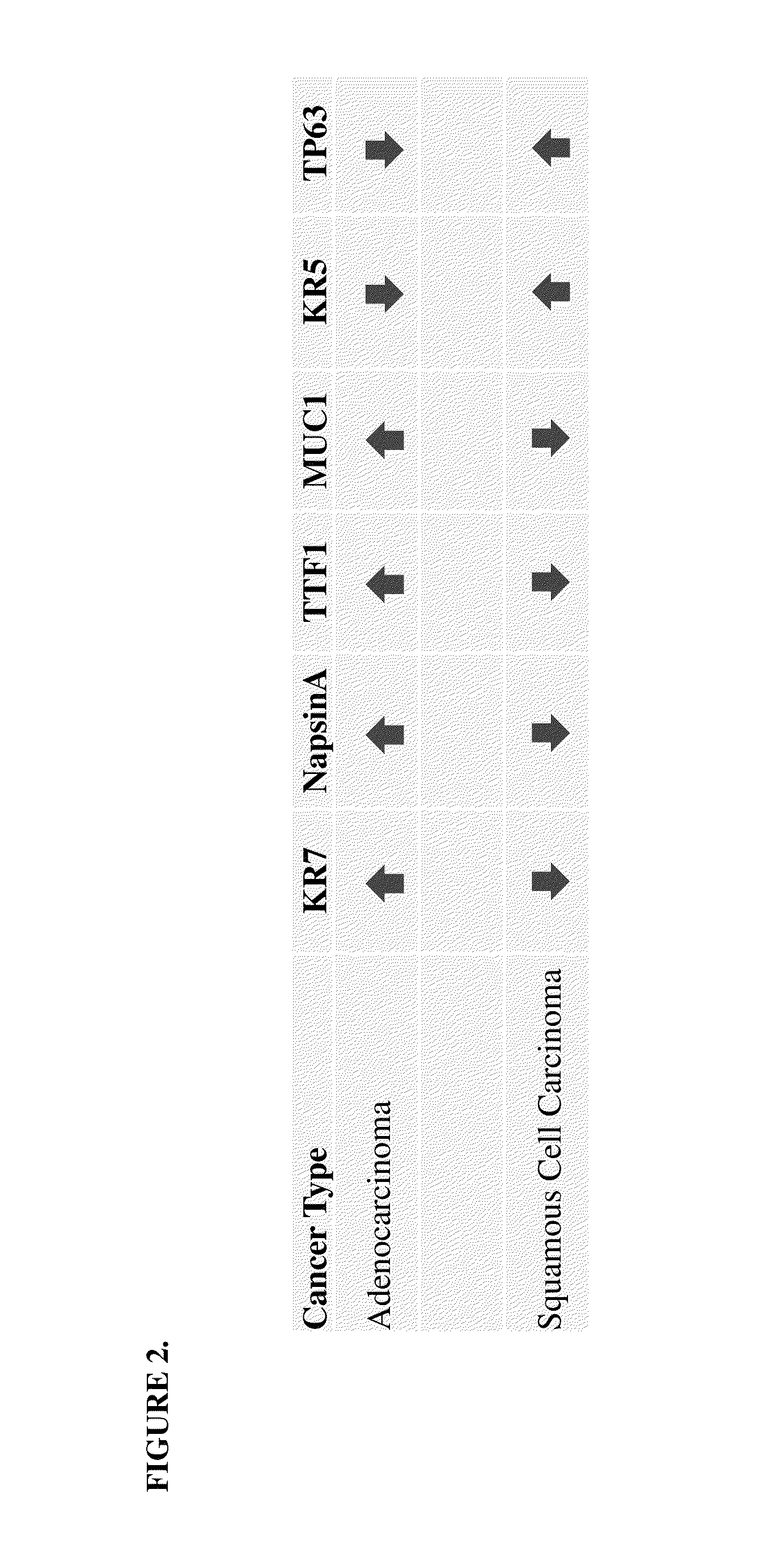 SRM/MRM assay for subtyping lung histology