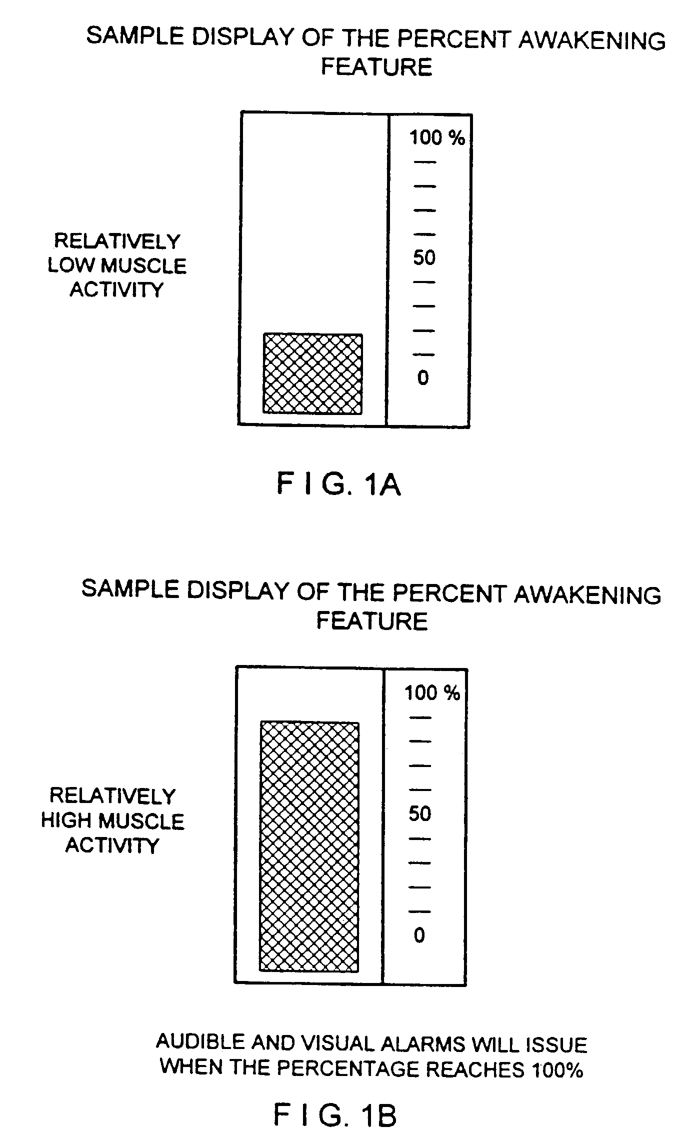 Monitoring and control for a laryngeal mask airway device