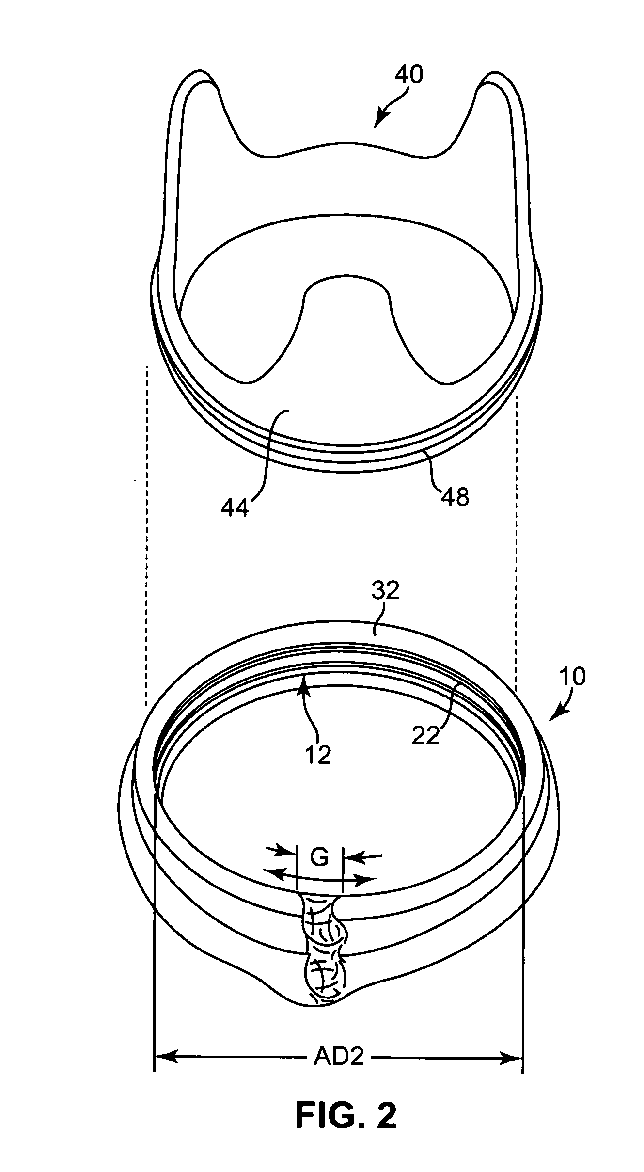 Suturing rings for implantable heart valve prostheses