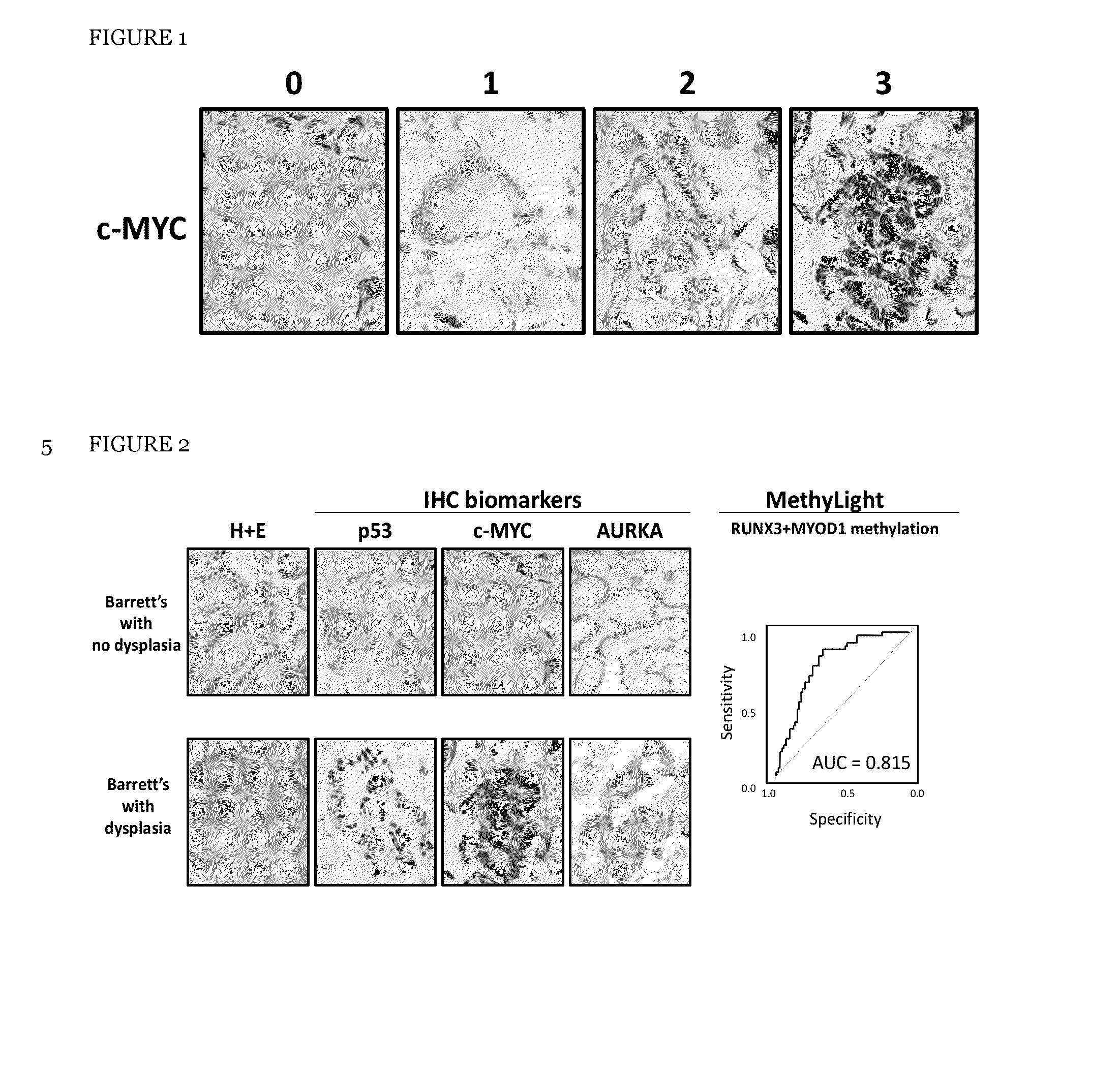 Method and apparatus of aiding detection of  surface abnormality in the oesophagus