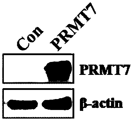 Method for constructing cell line capable of highly expressing PRMT7 and cell line