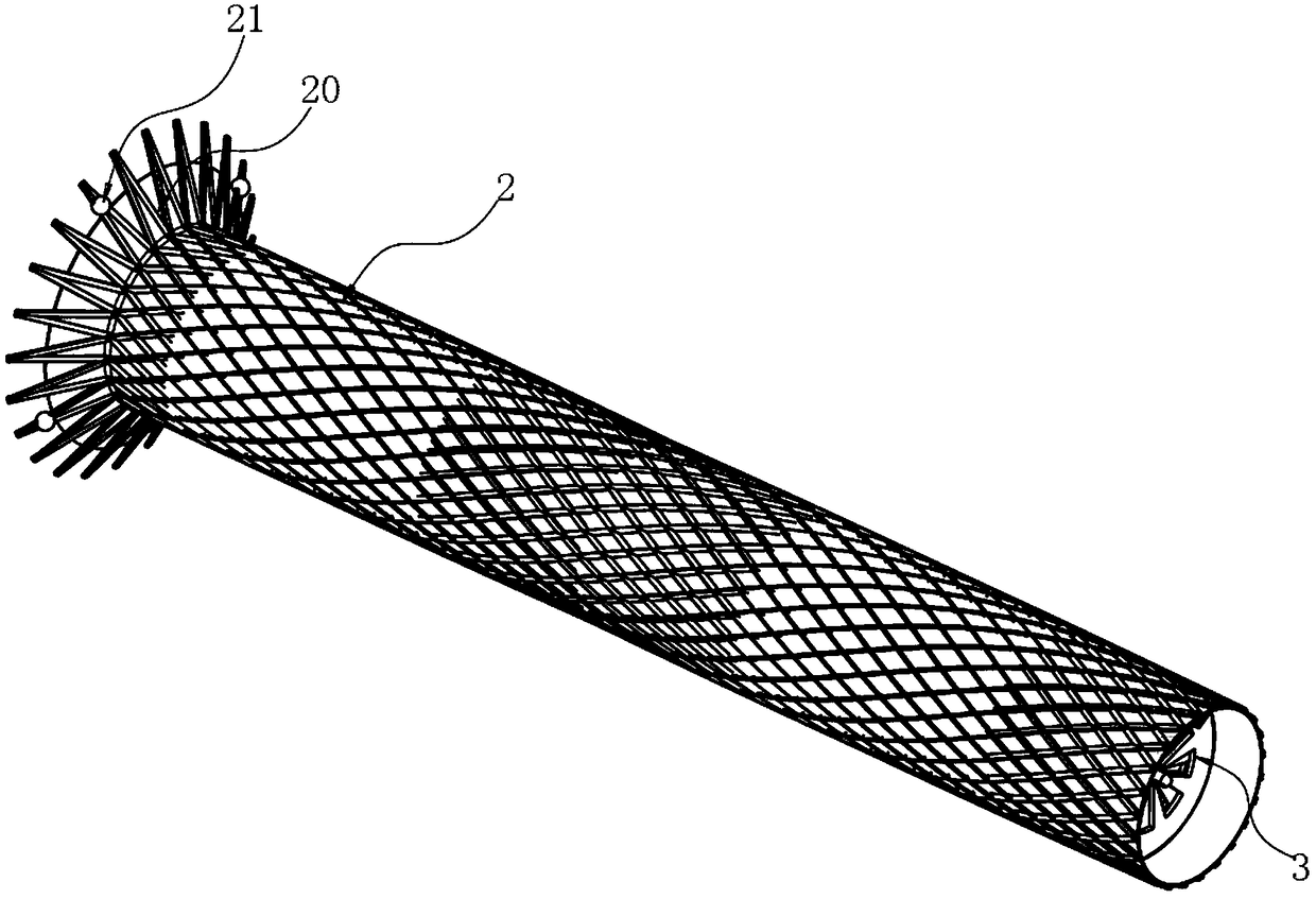 Intrahepatic portosystemic shunt stent