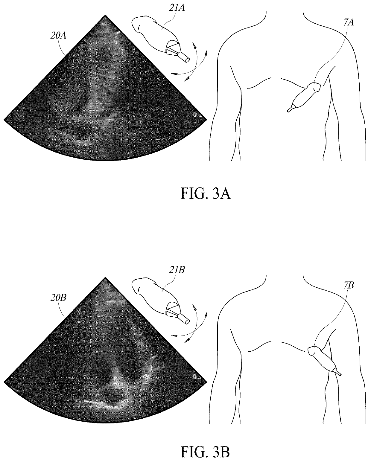 System and method for orientating capture of ultrasound images