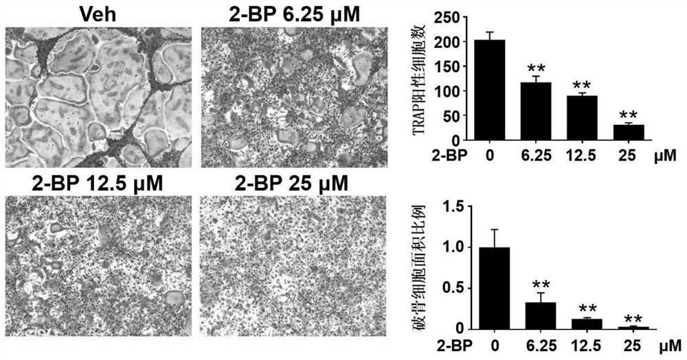 Application of 2-bromopalmitate in preparation of drugs for prevention and treatment of bone loss related diseases