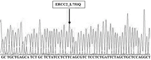 Primer for detecting ERCC2 gene polymorphism, and method thereof