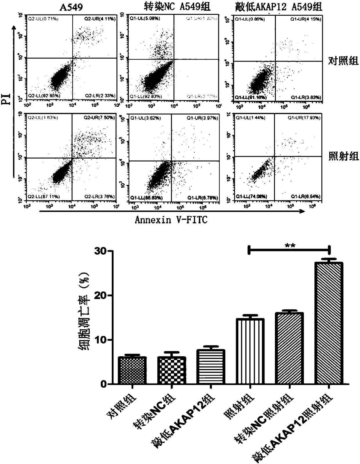 Application of reagent for inhibiting or down-regulating expression of AKAP12 gene in preparation of tumor radiotherapy sensitizing drugs