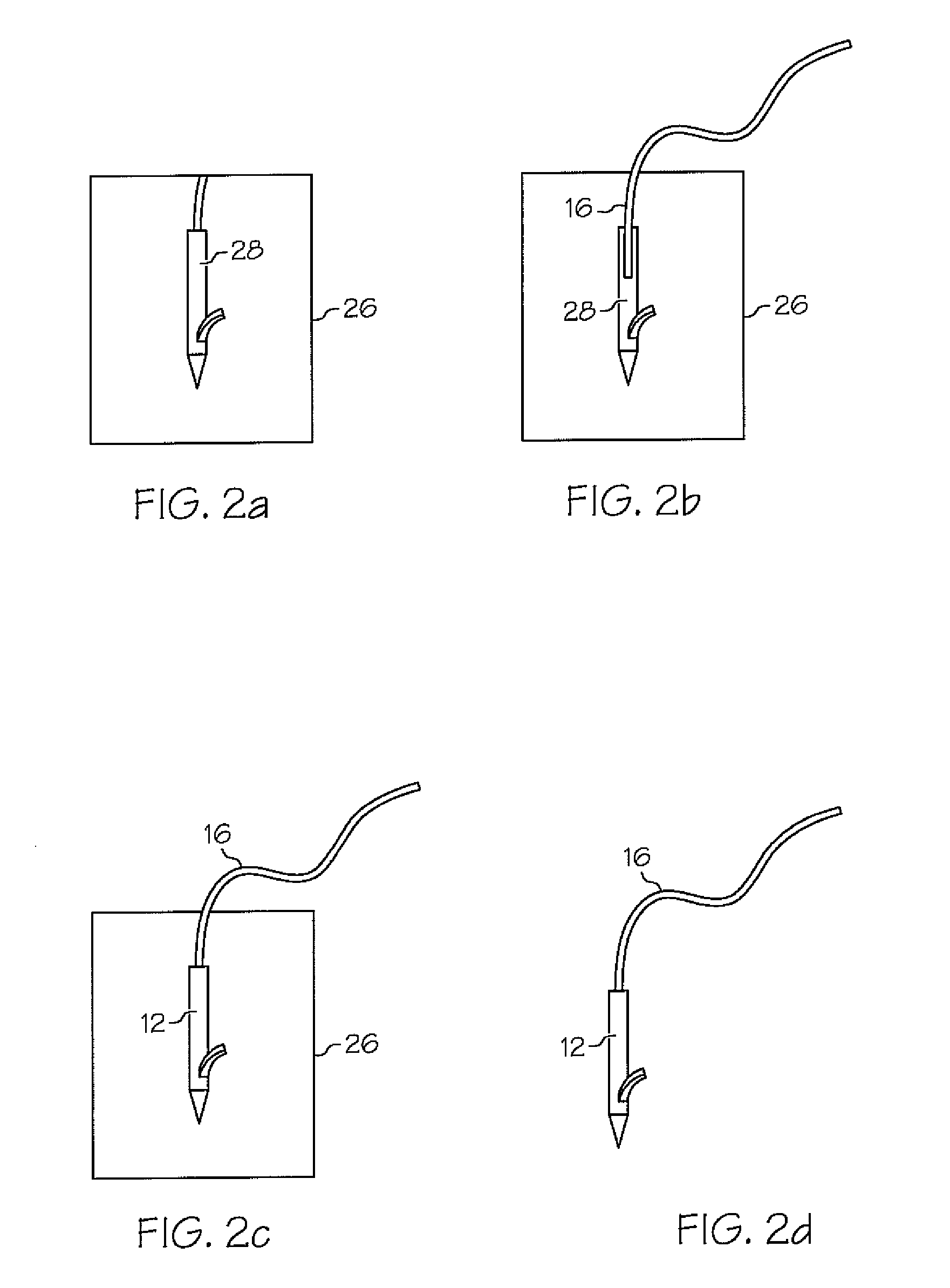Suture anchoring system