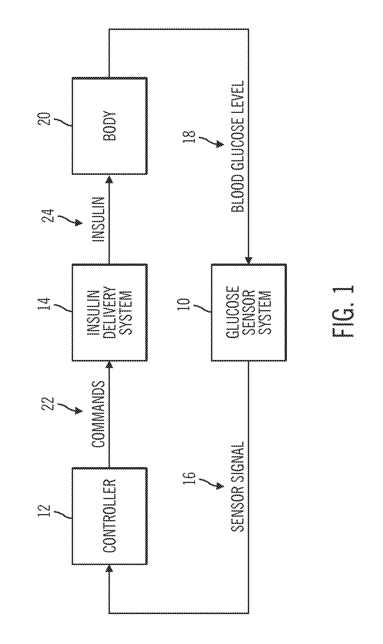 Insulin on board compensation for a closed-loop insulin infusion system