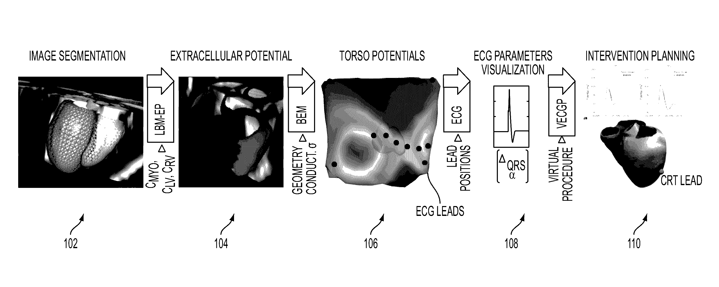 System and method for patient specific planning and guidance of electrophysiology interventions
