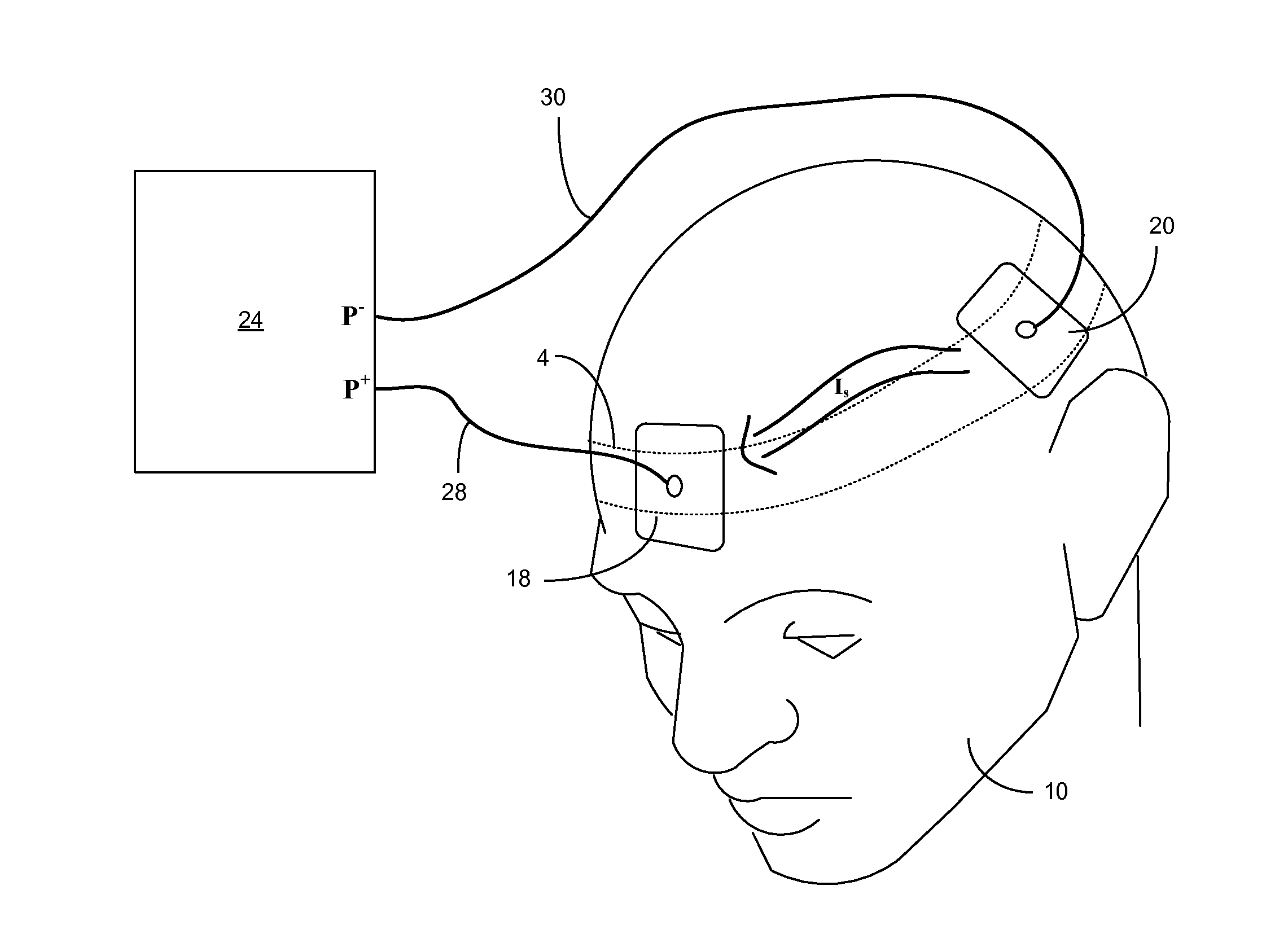 Electrode for use with transcranial direct current stimulation