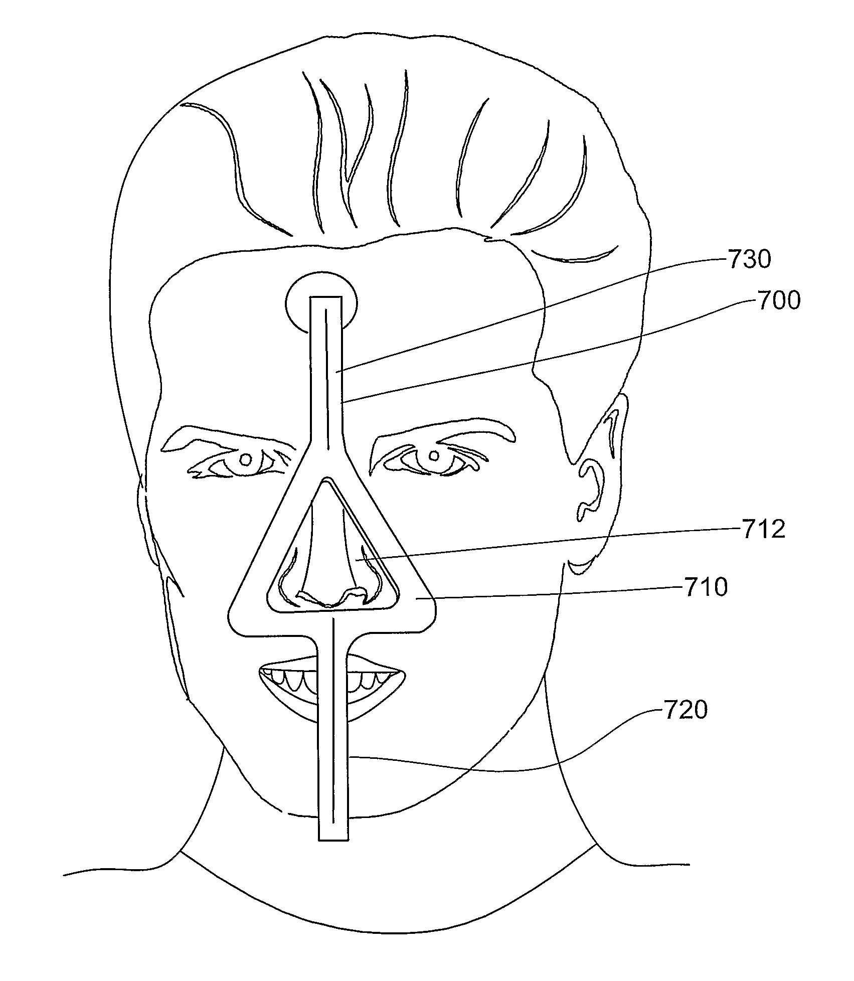 Methods, apparatus and system for use in dental procedures