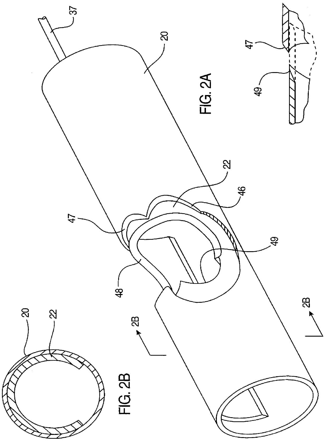 Apparatus and method for removing occluding material from body lumens