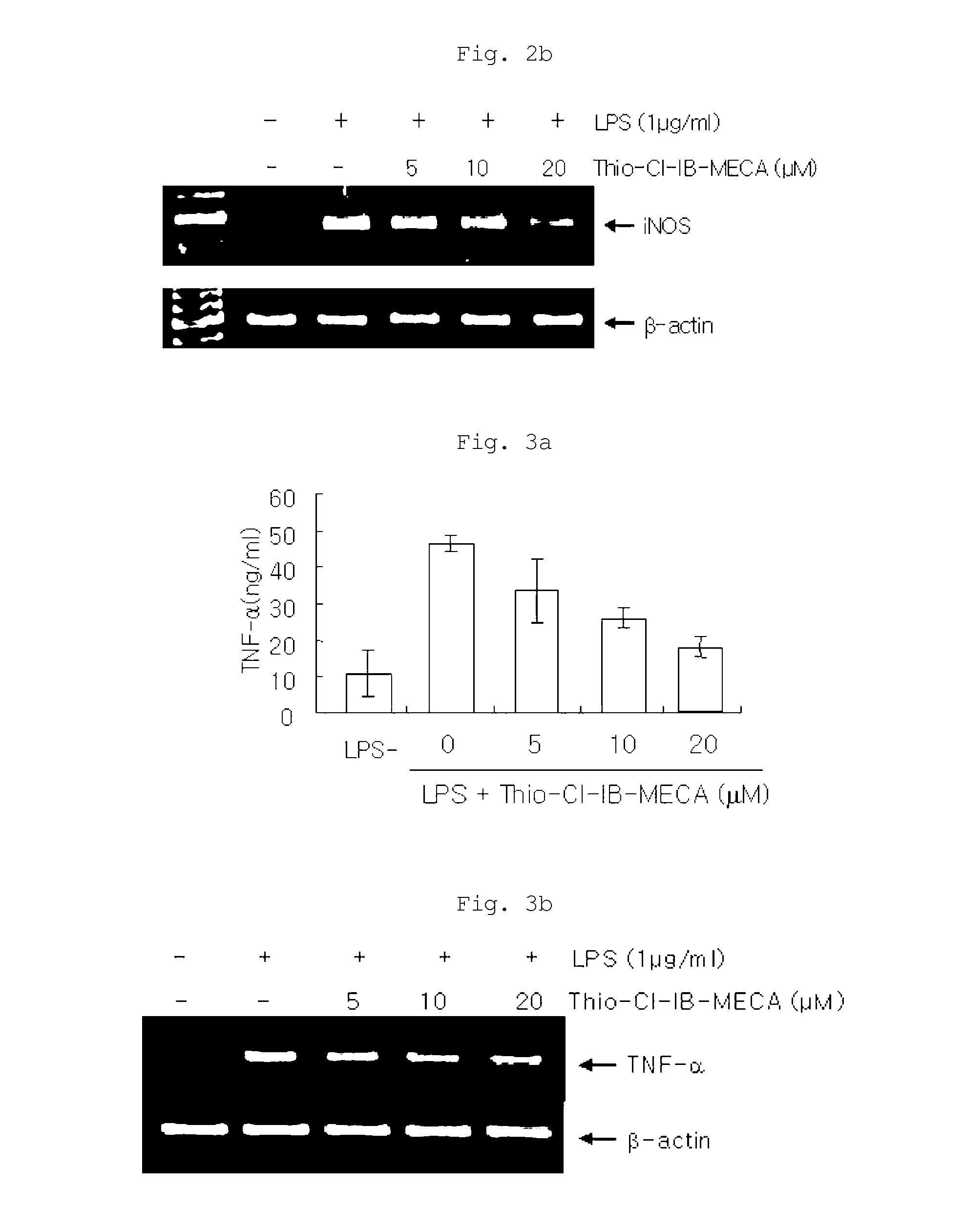 Pharmaceutical composition containing a3 adenosine receptor agonist