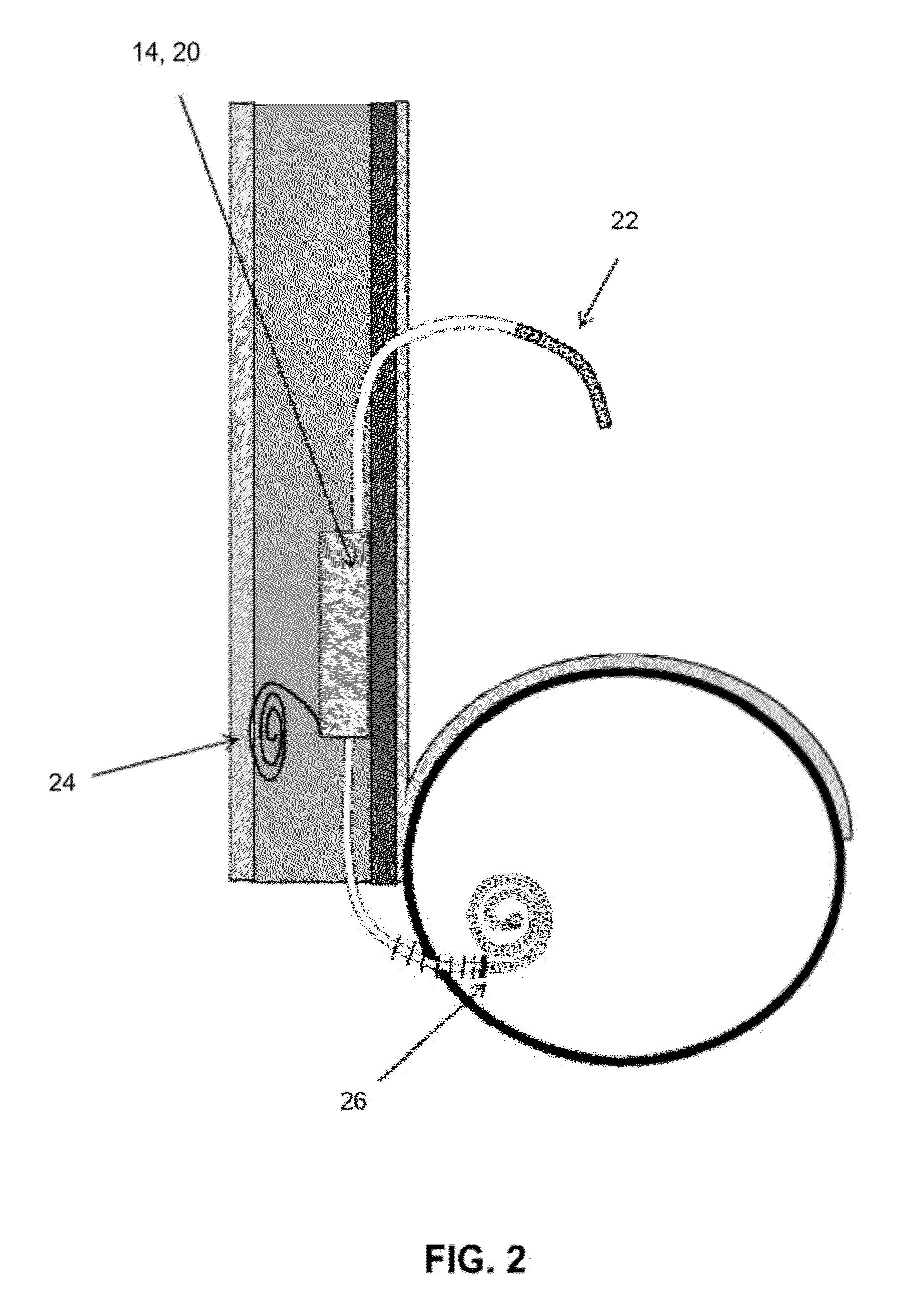 Method and apparatus for automated active sterilization of fully implanted devices