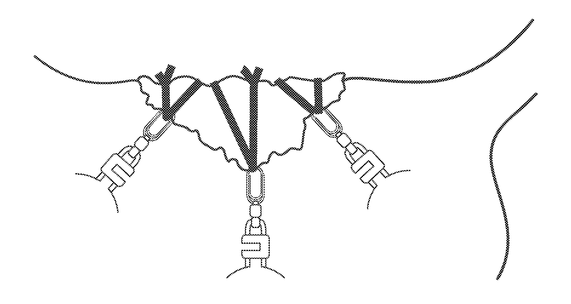 Device for Securing an Object to a Subject and Wound Closure