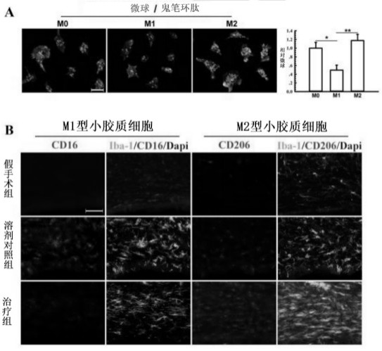 Polypeptide analogue and application thereof in medicines for intervention treatment of cerebral hemorrhage