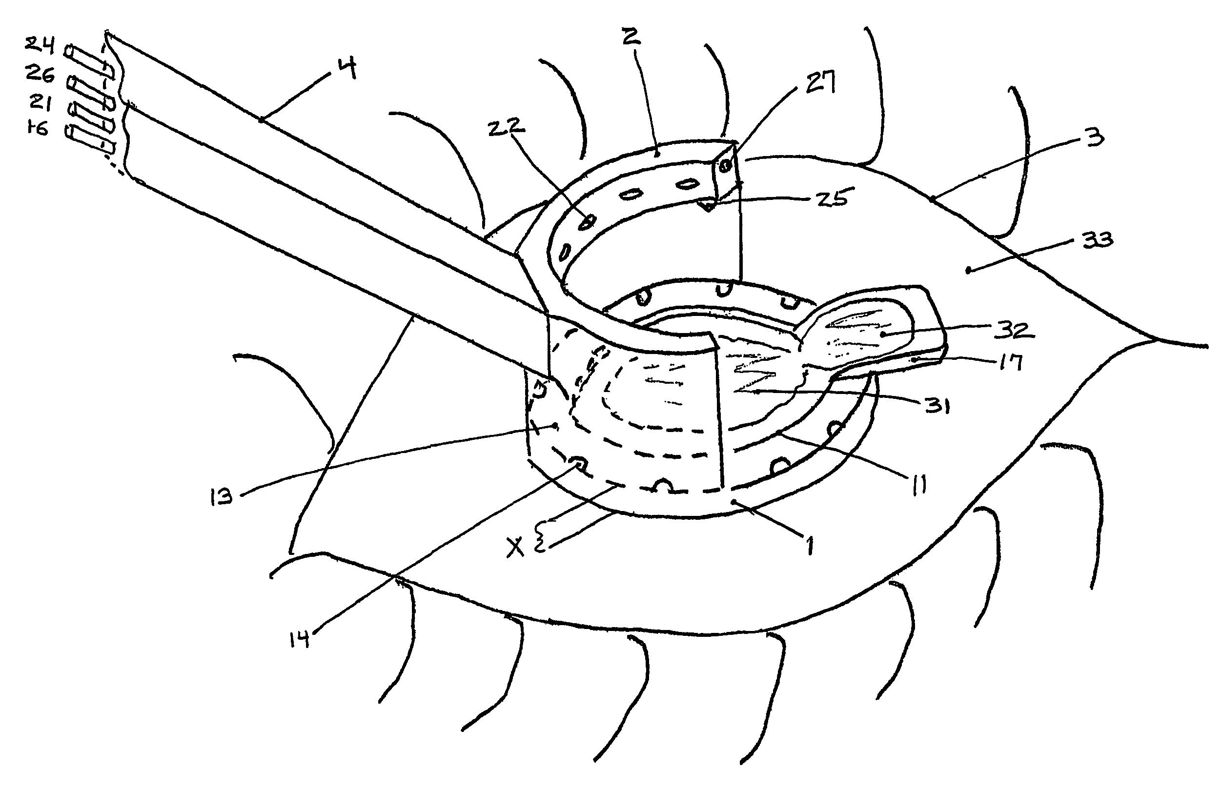 Multi-function surgical instrument for facilitating ophthalmic laser surgery