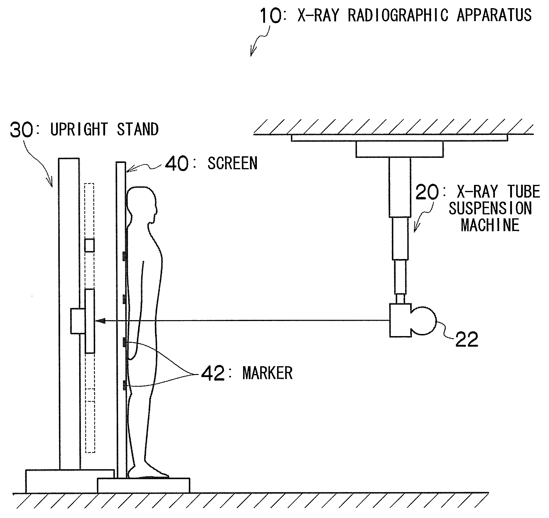 X-ray radiographic apparatus and method