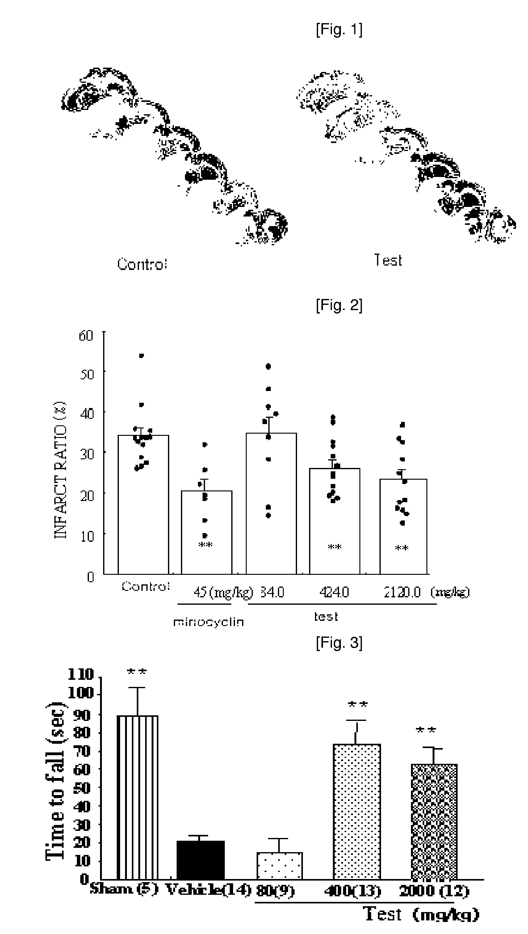 Composition Comprising the Extract of Crude Drug Complex Having Neuroprotective Activity For Preventing and Treating Stroke and Neurodegenerative Diseases