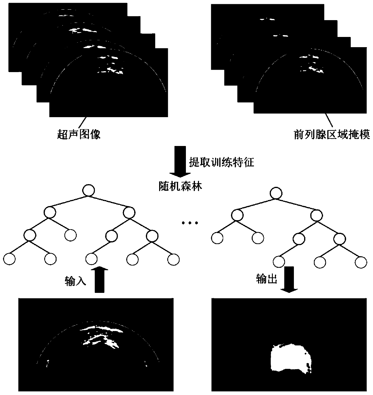 Prostate nuclear magnetism ultrasonic image registration fusion method