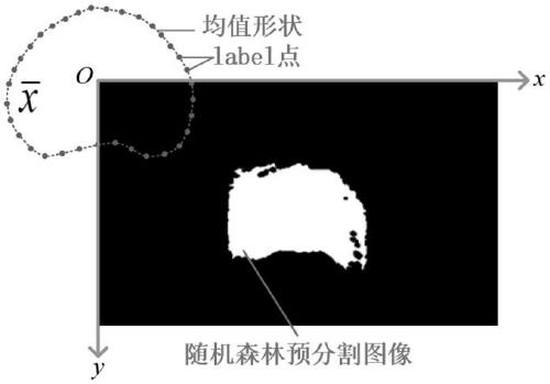 Prostate nuclear magnetism ultrasonic image registration fusion method