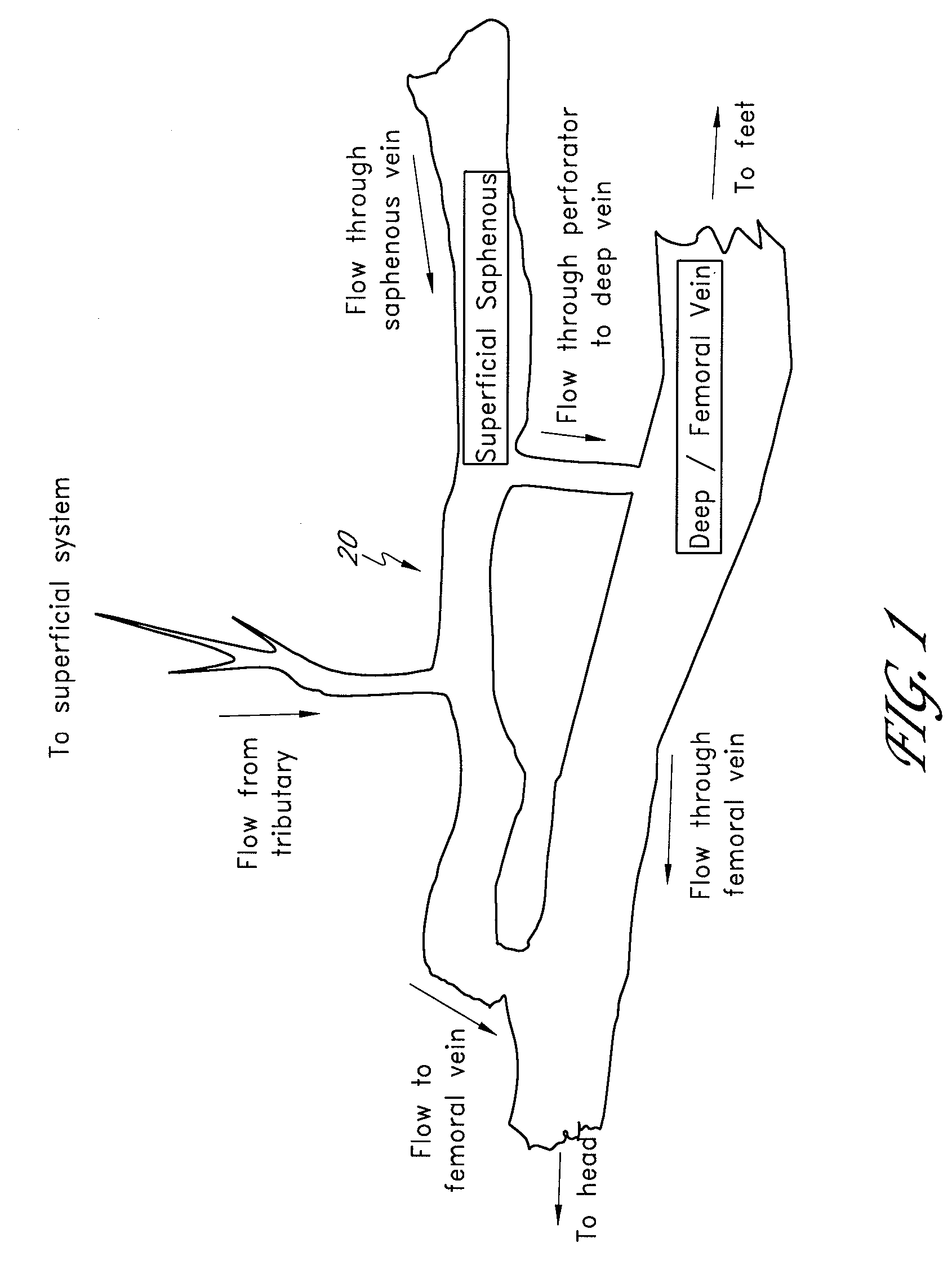 Method and apparatus for implanting an occlusive structure