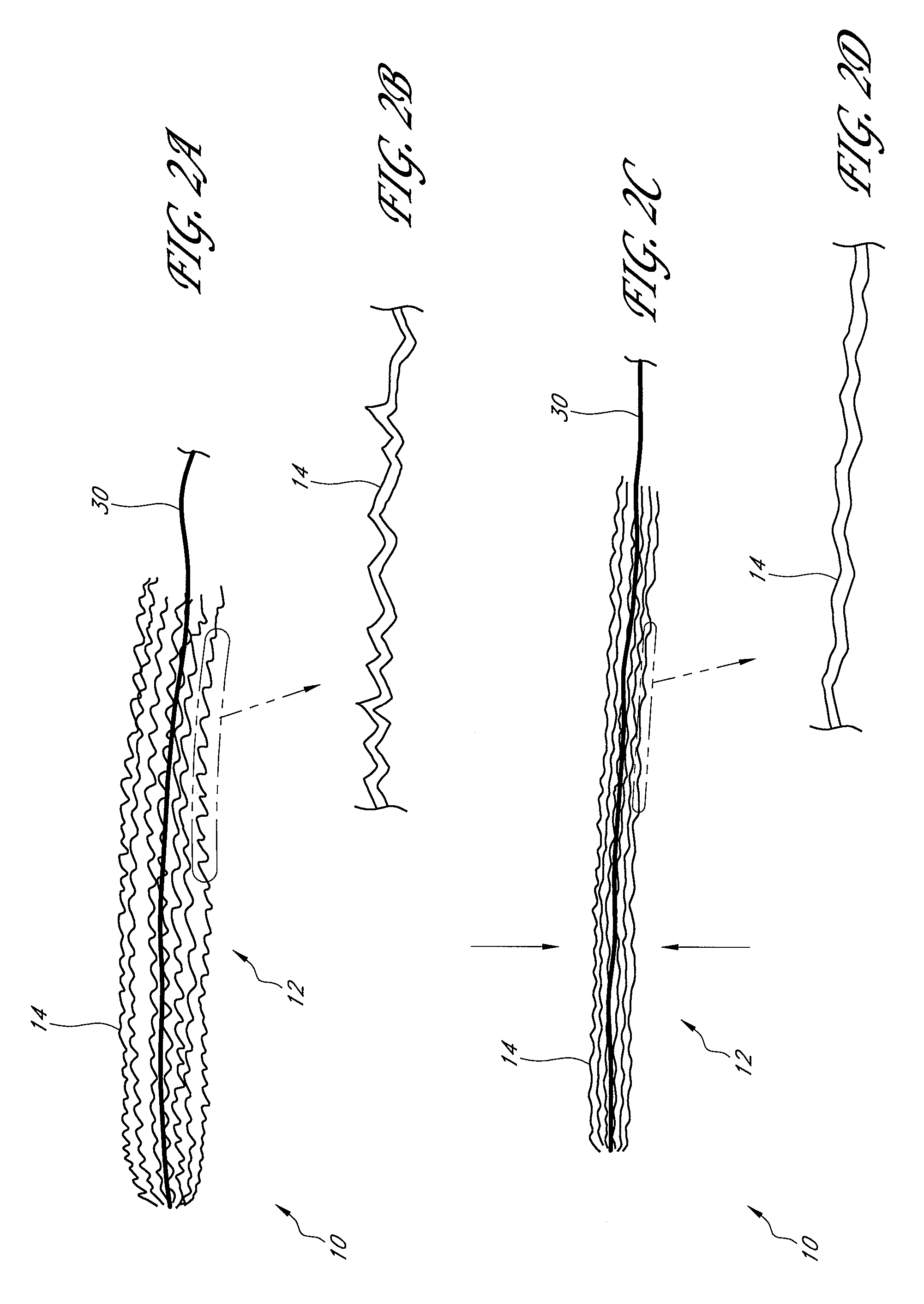Method and apparatus for implanting an occlusive structure