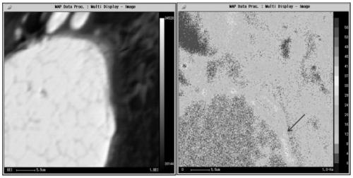 Preparation of oxide dispersion strengthened ferrite steel by surface oxidation and explosive compaction