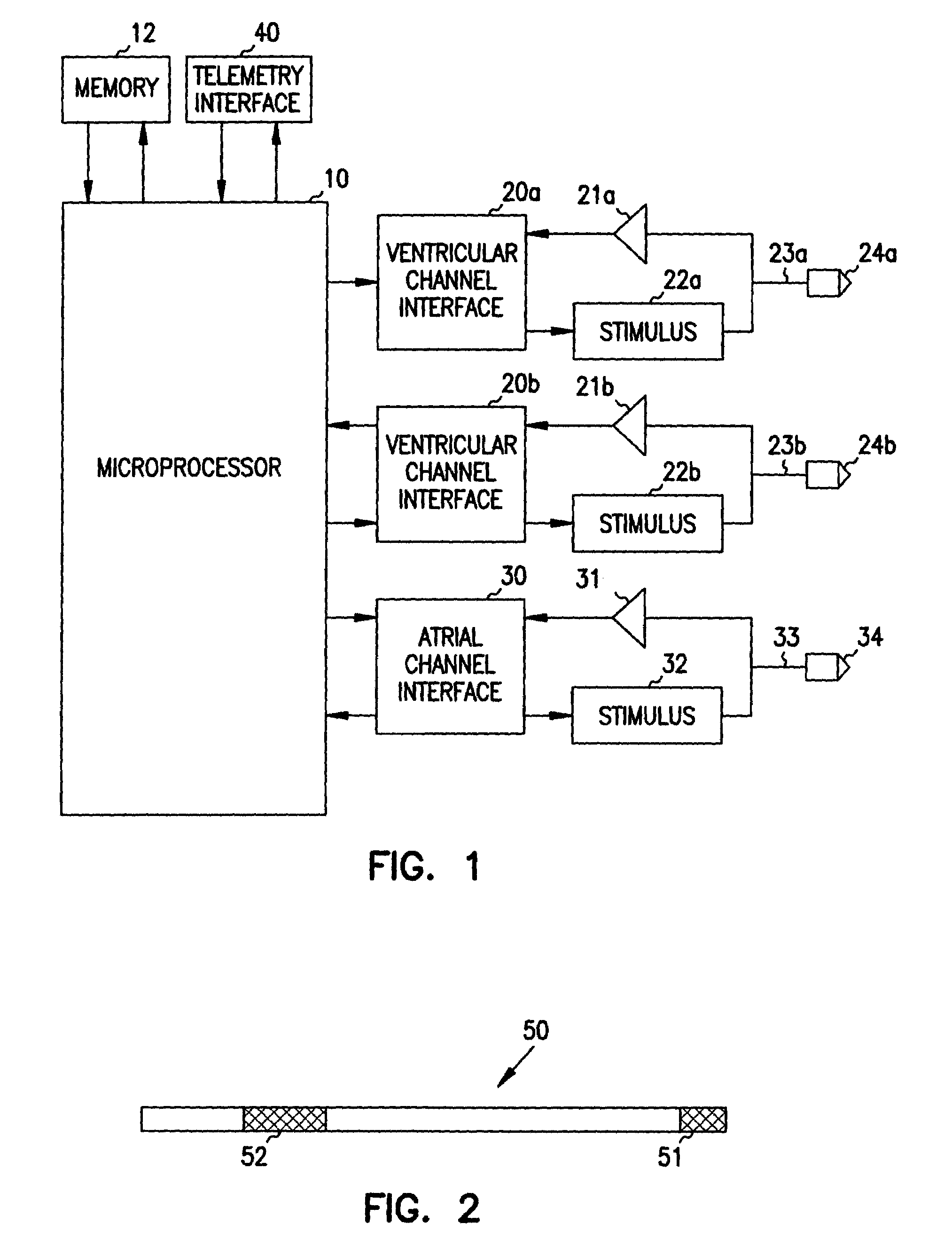 Apparatus and method for spatially and temporally distributing cardiac electrical stimulation