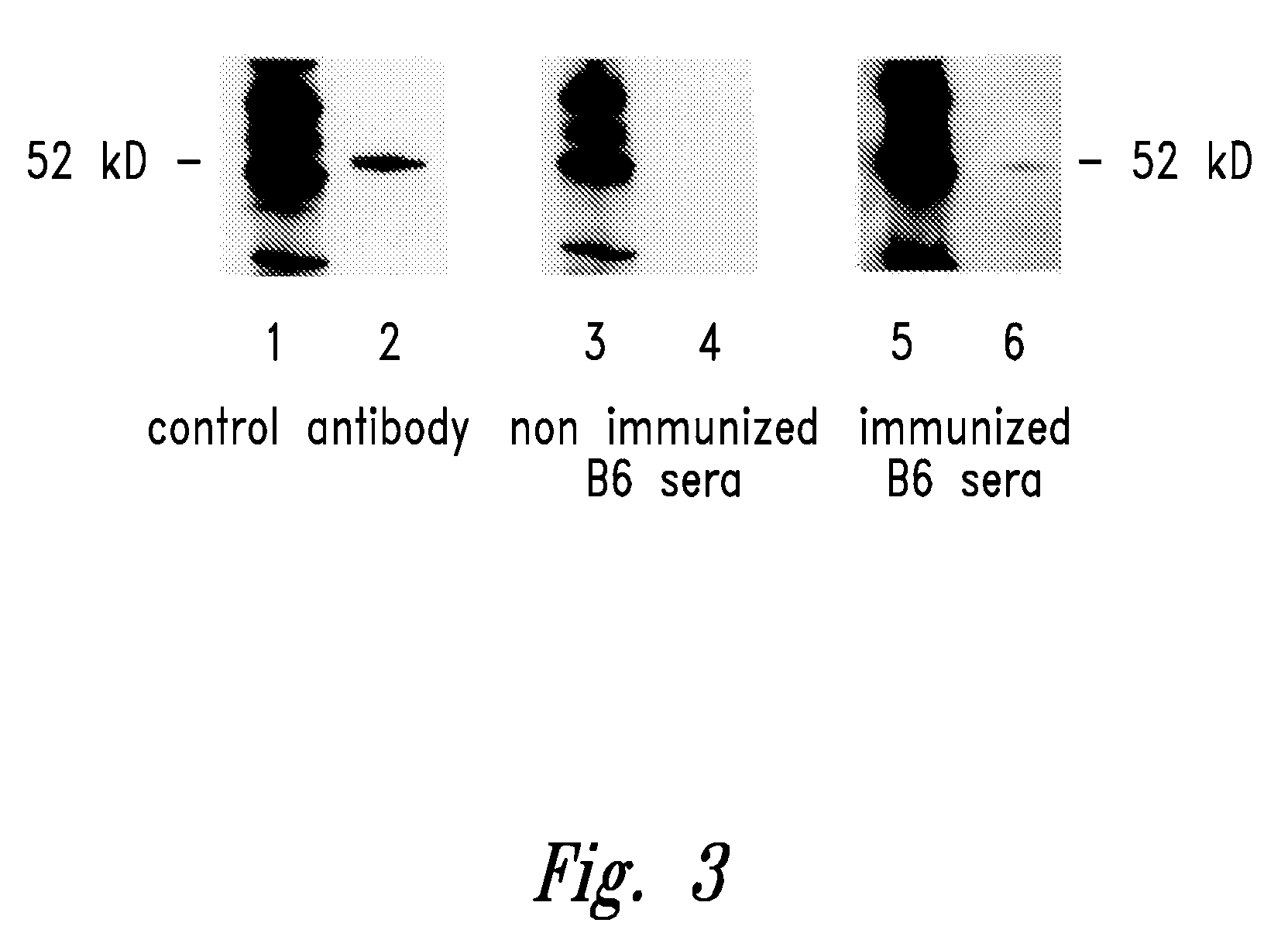 Compositions and methods for wt1 specific immunotherapy