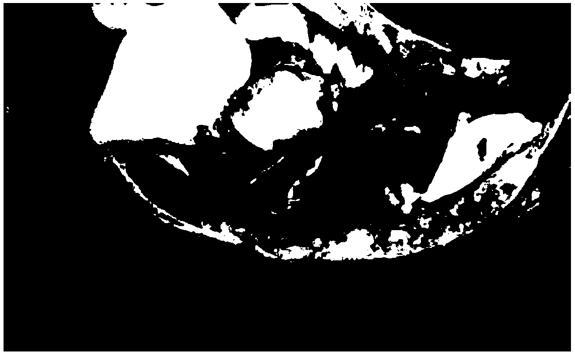 Pharmaceutical composition and feed for treating intussusception disease of grouper and preparation method of pharmaceutical composition and feed