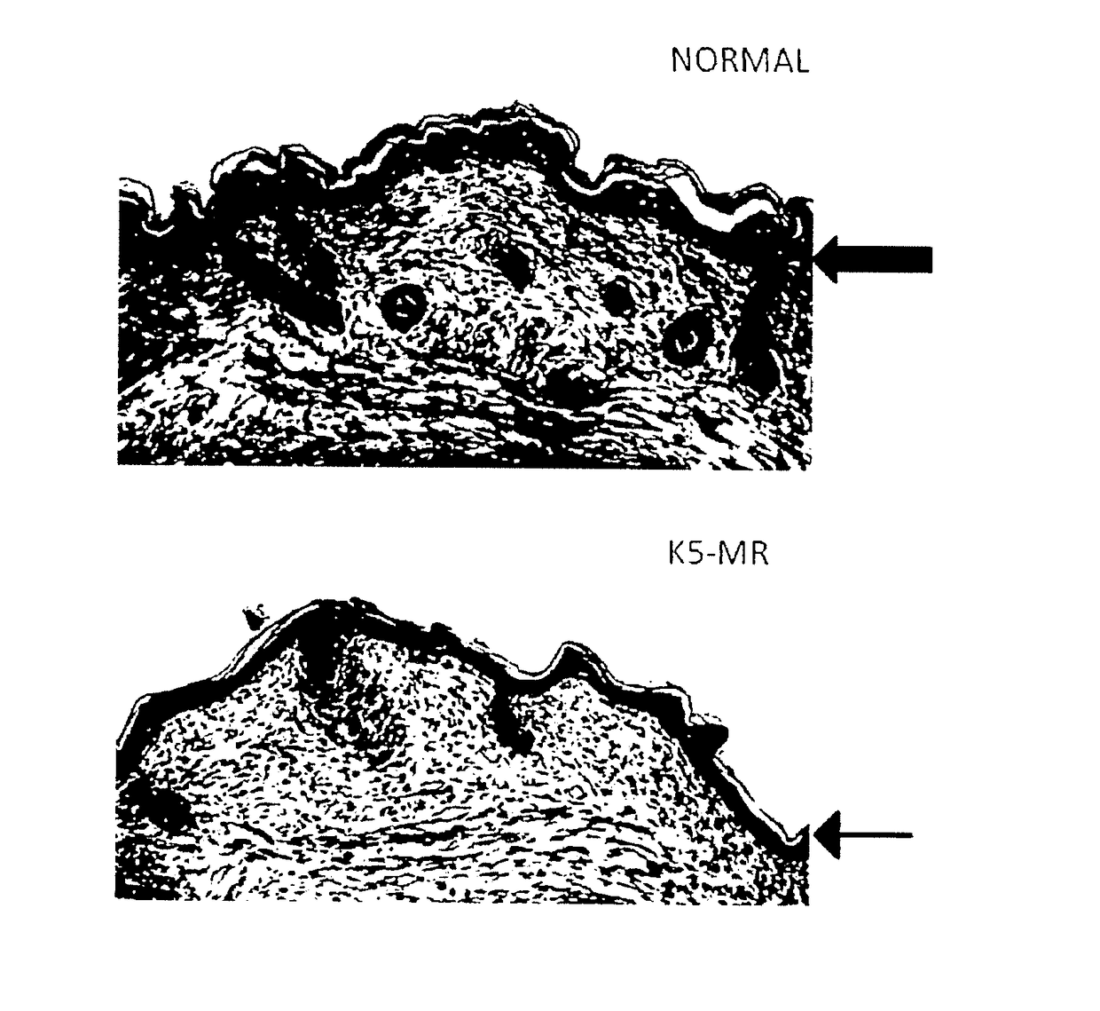 Pharmaceutical compositions for preventing glucocorticoid-induced corneal or skin thinning