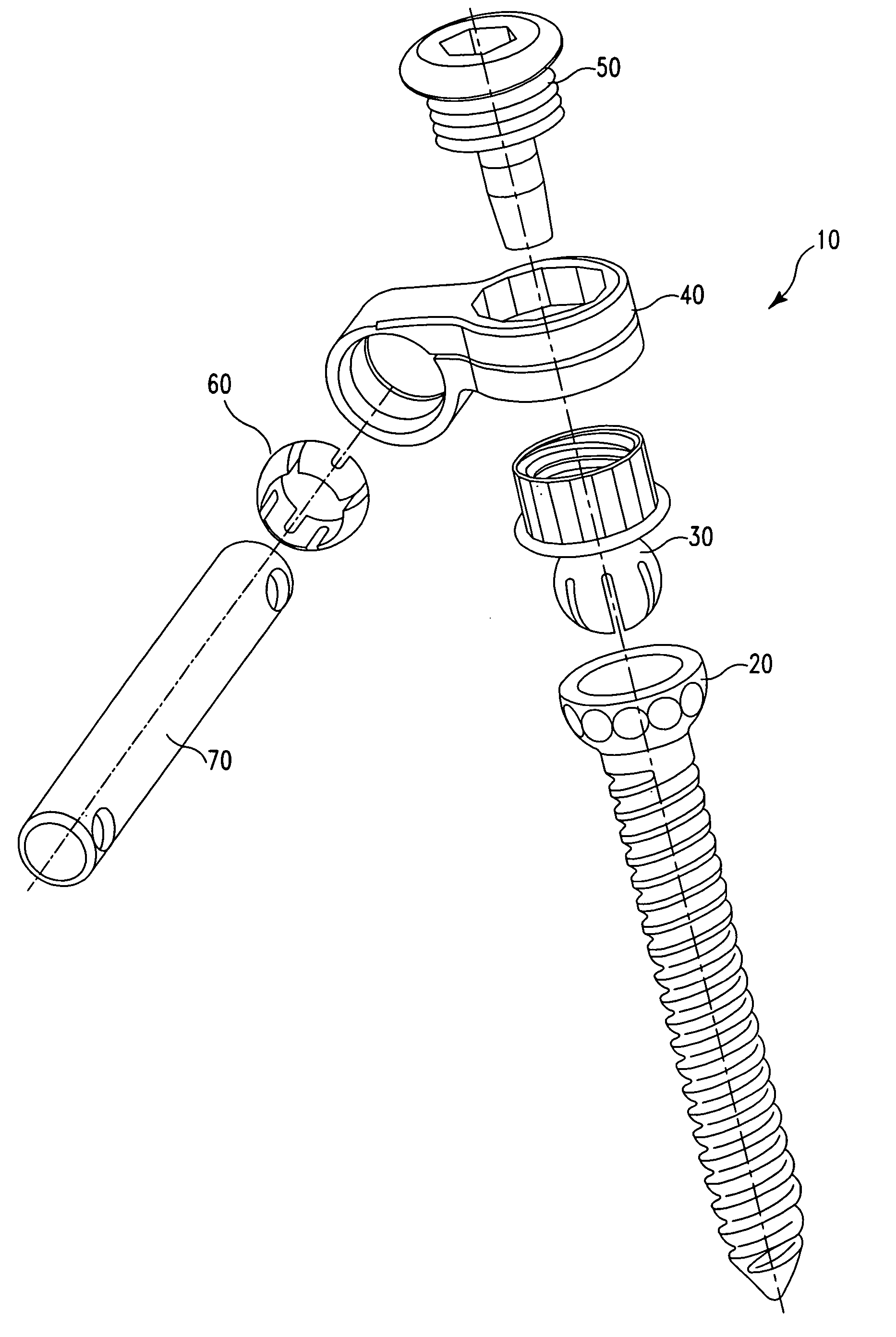 Medialised rod pedicle screw assembly